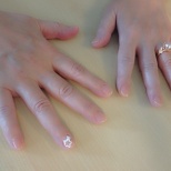 Luminastar Nail (2/2)